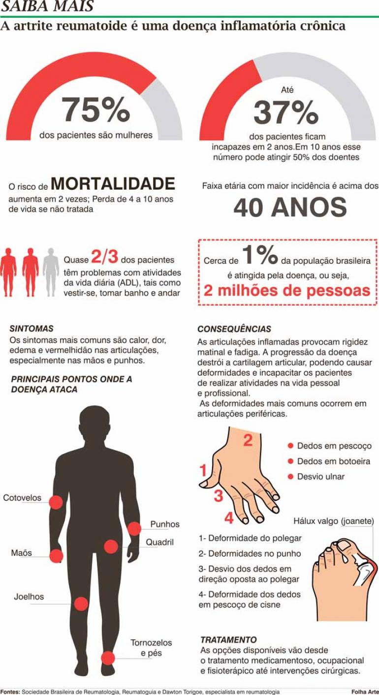 Artrite reumatoide atinge 1% da população