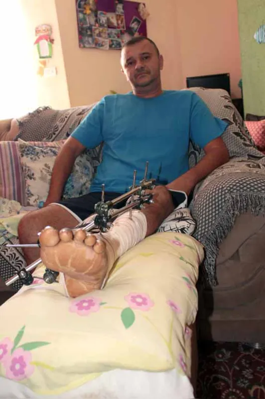 Rinaldo Barbosa Silva espera que na consulta desta quarta (5) em Curitiba o tratamento de sua perna receba a atenção e urgência necessárias