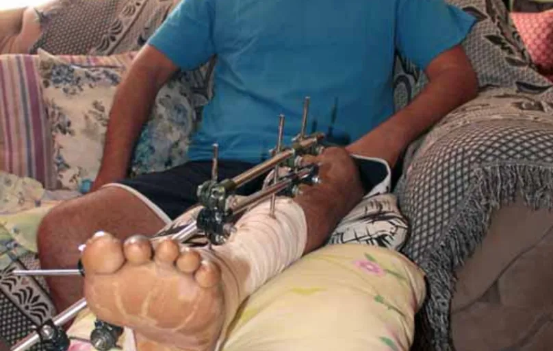 Rinaldo Barbosa Silva espera que na consulta desta quarta (5) em Curitiba o tratamento de sua perna receba a atenção e urgência necessárias