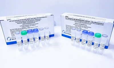 Imagem ilustrativa da imagem Anvisa aprova o registro do primeiro teste para diagnosticar Monkeypox