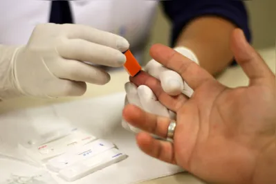 Para Barreira, "eliminação" da Aids é um termo possível e alcançável até 2030, conforme a meta proposta pela OMS