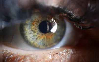 Imagem ilustrativa da imagem Exame oftalmológico pode ajudar no diagnóstico de esquizofrenia
