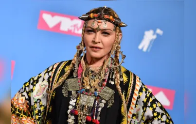 Imagem ilustrativa da imagem Madonna recebe alta em hospital, após grave infecção
