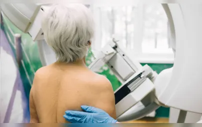 Imagem ilustrativa da imagem Um milhão de mulheres deixaram de realizar mamografia