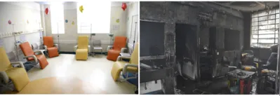 Imagem ilustrativa da imagem Pequeno Príncipe contabiliza danos após incêndio que destruiu ambulatório