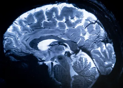 Potência permite que a máquina escaneie imagens 10 vezes mais precisas que os IRM normalmente utilizados em hospitais