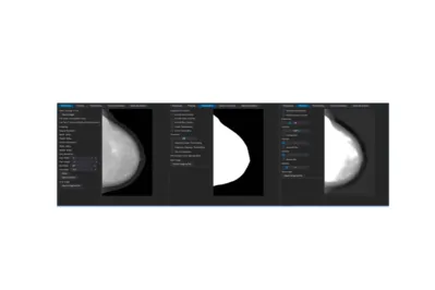 Imagem ilustrativa da imagem Software desenvolvido na UEL avalia progressão do câncer de mama