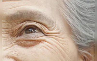 Imagem ilustrativa da imagem Imagens do rosto, língua e retina ajudam a calcular idade biológica