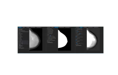 Imagem ilustrativa da imagem Software desenvolvido na UEL avalia progressão do câncer de mama