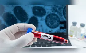 Sesa confirma primeiros casos de Mpox em Londrina neste ano