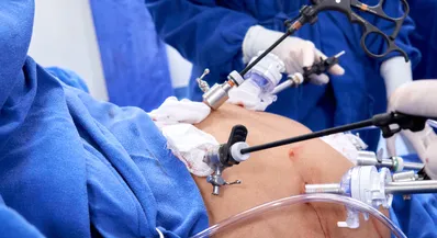 Imagem ilustrativa da imagem Oferta de tratamento para obesidade grave é restrito