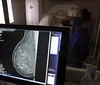 Ministério da Saúde passa a recomendar mamografia a partir dos 40 anos