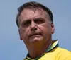 Cirurgia para curar soluços de Bolsonaro correu bem, diz médico