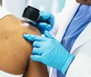Casos de câncer de pele saltam de 4 mil para mais de 72 mil em 10 anos