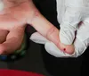 Teste rápido para dengue está disponível no SUS; saiba como funciona