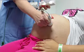 Gestantes do PR poderão fazer ultrassom morfológico pelo SUS