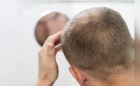 Queda de cabelo: uso indiscriminado de suplementos pode mascarar doenças