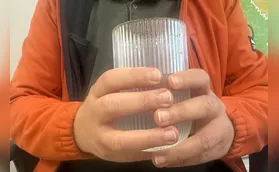 Beber pouca água no frio pode causar problemas renais