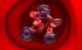 Paraná deve registrar 840 novos casos de leucemia por ano até 2028