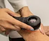Apucarana promove mutirão de prevenção do câncer de pele