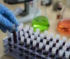 Pesquisas brasileiras avançam no diagnóstico de Alzheimer