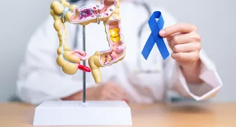 Sinais do câncer colorretal devem ser checados com rapidez