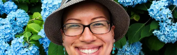 Imagem ilustrativa da imagem Saiba mais sobre a alopecia areata, uma doença ‘imprevisível’
