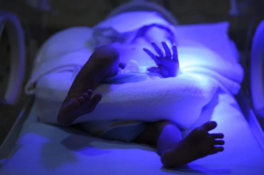 DIFÍCIL SOLUÇÃO - Mortalidade neonatal desafia Saúde
