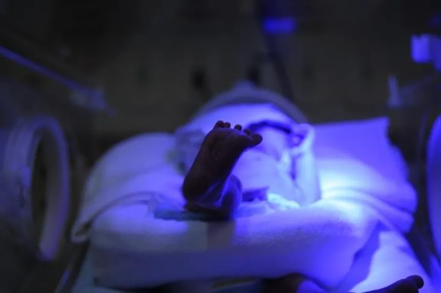 DIFÍCIL SOLUÇÃO - Mortalidade neonatal desafia Saúde