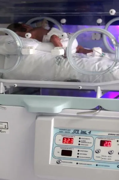 Médicos pedem atenção à saúde do prematuro