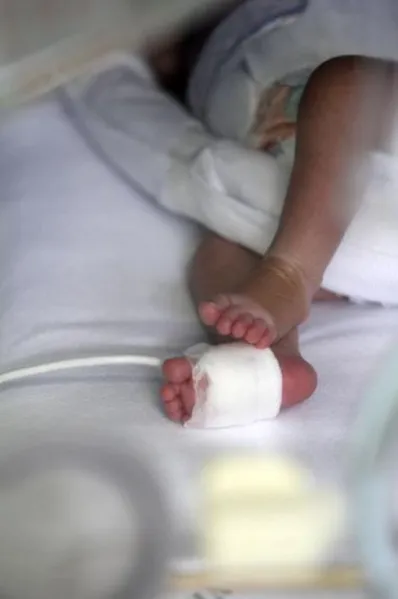 Médicos pedem atenção à saúde do prematuro