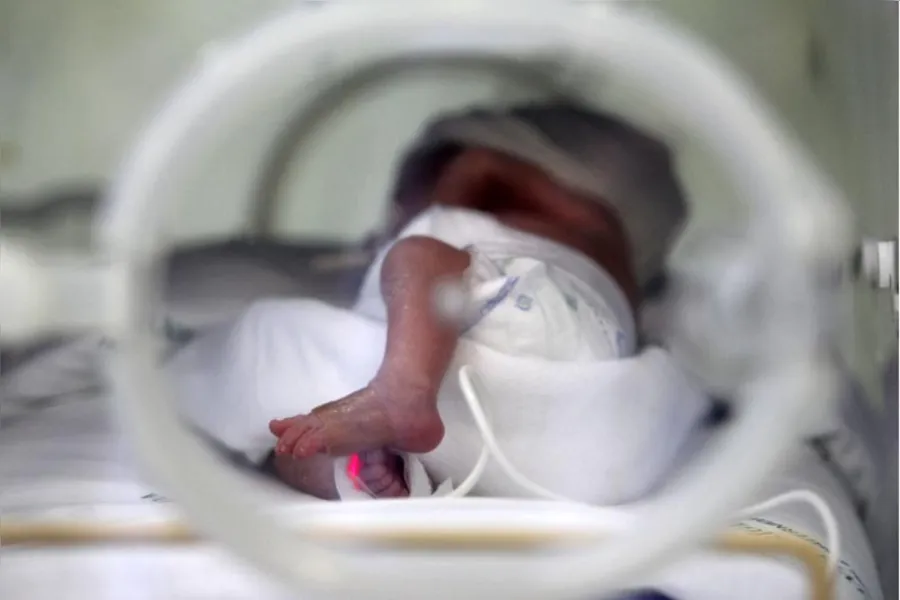 Médicos pedem atenção à saúde do prematuro