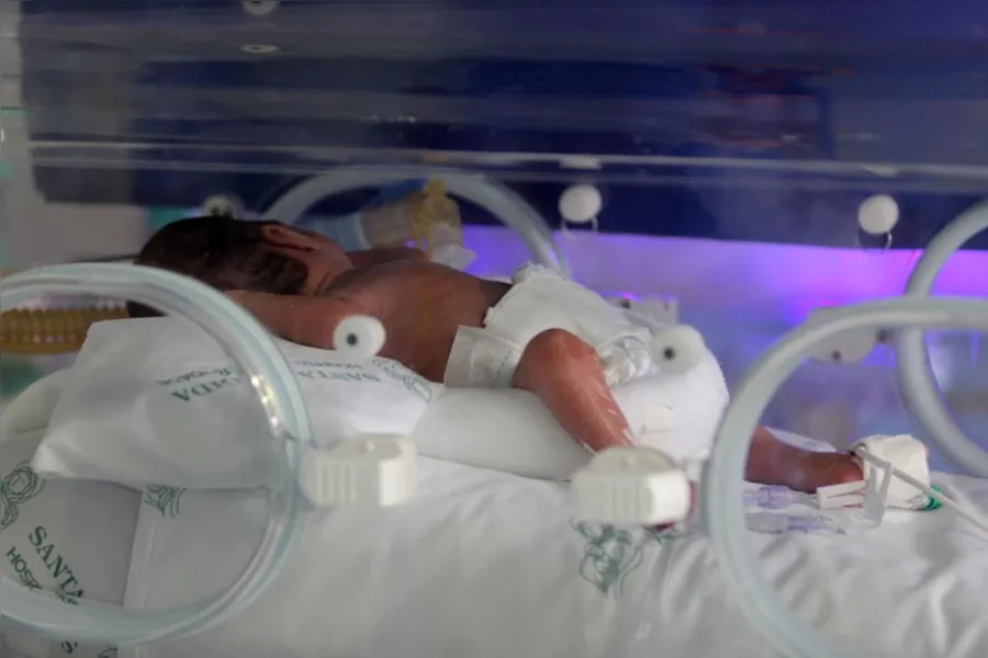 Médicos pedem atenção à saúde do prematuro