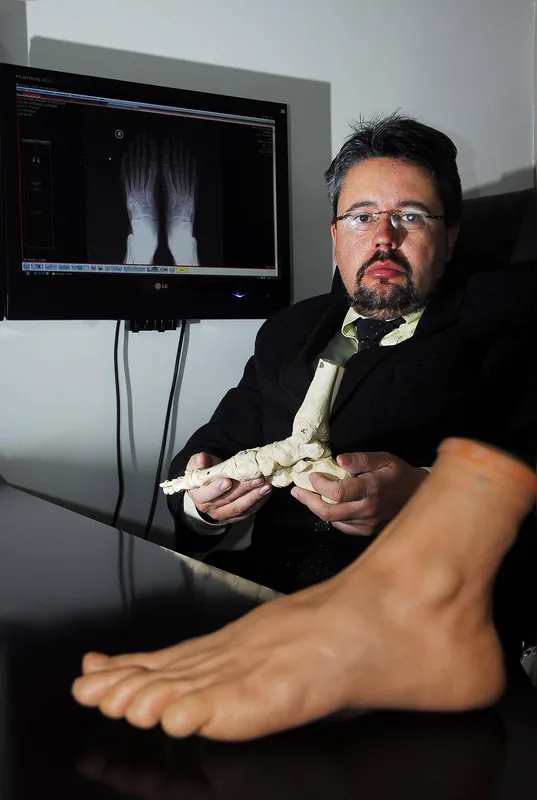 ''É uma consequência natural do envelhecimento, sendo mais comum em adultos e pessoas da terceira idade'', explica o ortopedista Marco Antônio Batista