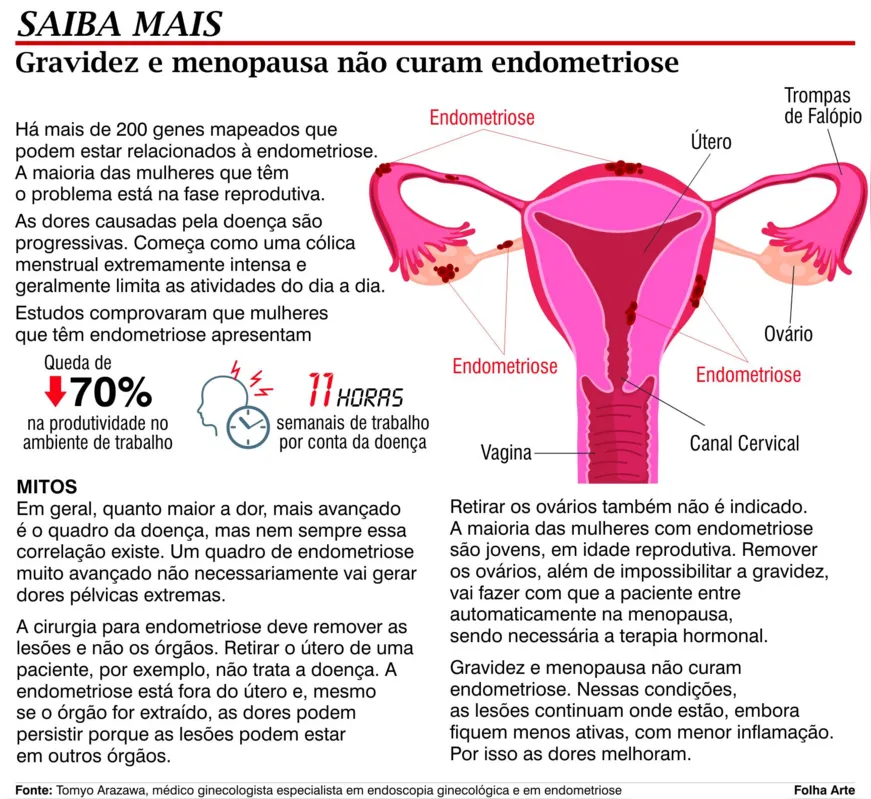 Imagem ilustrativa da imagem Dor pélvica não é normal e pode ser sinal de endometriose