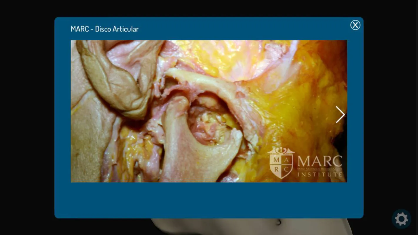 Face 3D Plus, um atlas craniano interativo,  facilita o estudo da complexidade da anatomia de cabeça e pescoço