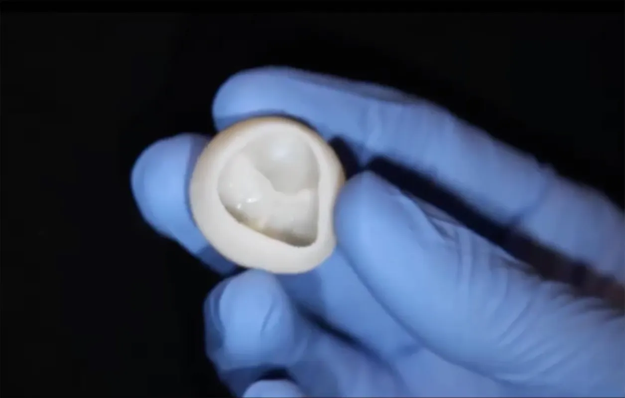 Imagem ilustrativa da imagem Cientistas anunciam avanço em impressão 3D de partes do coração