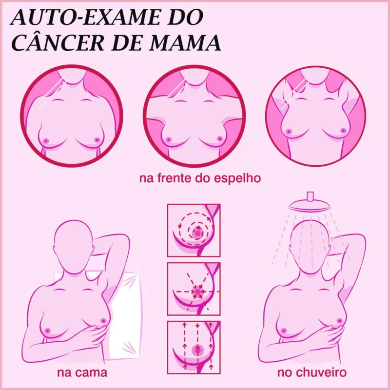Imagem ilustrativa da imagem A Vitória contra o câncer de mama