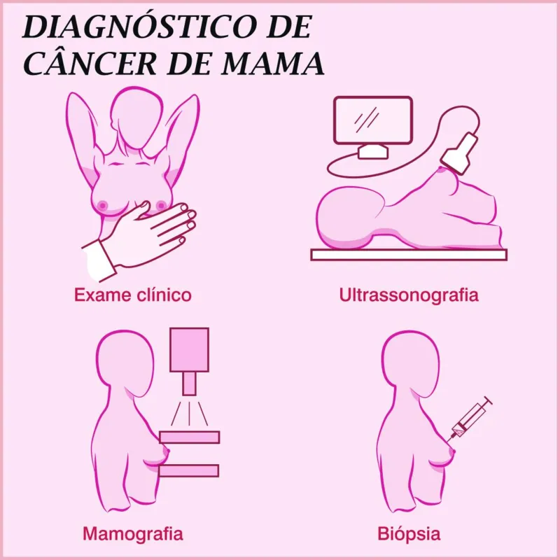 Imagem ilustrativa da imagem A Vitória contra o câncer de mama
