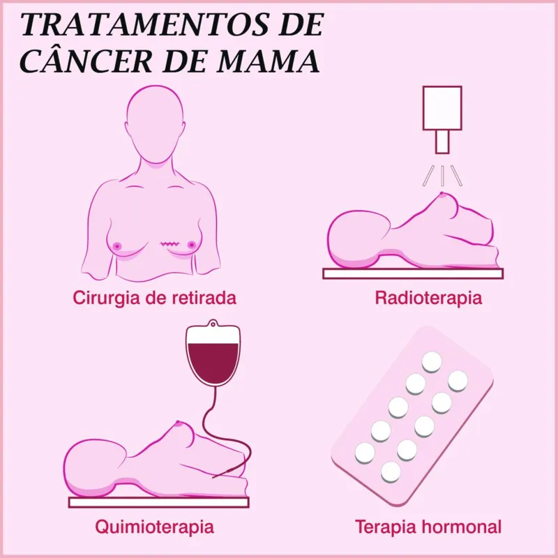 Imagem ilustrativa da imagem A Vitória contra o câncer de mama