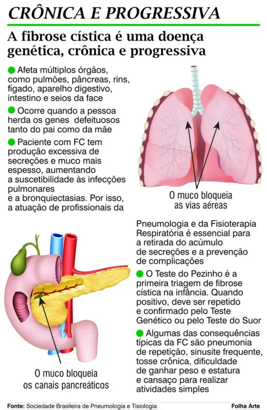 Imagem ilustrativa da imagem Fibrose cística exige rotina de cuidados e tratamento multidisciplinar