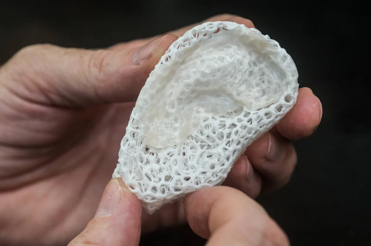   “Para reconstruir uma orelha, por exemplo, é possível imprimir estruturas tridimensionais com material biodegradável, que são rejeitados pelo corpo. Os espaços vazios são preenchidos com essa nanocelulose", detalha o professor 