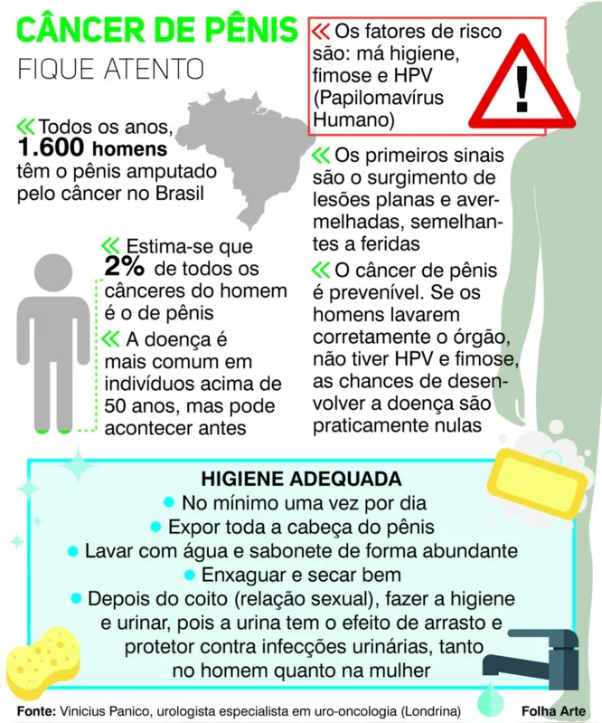 Imagem ilustrativa da imagem Falta de higiene do pênis pode causar câncer