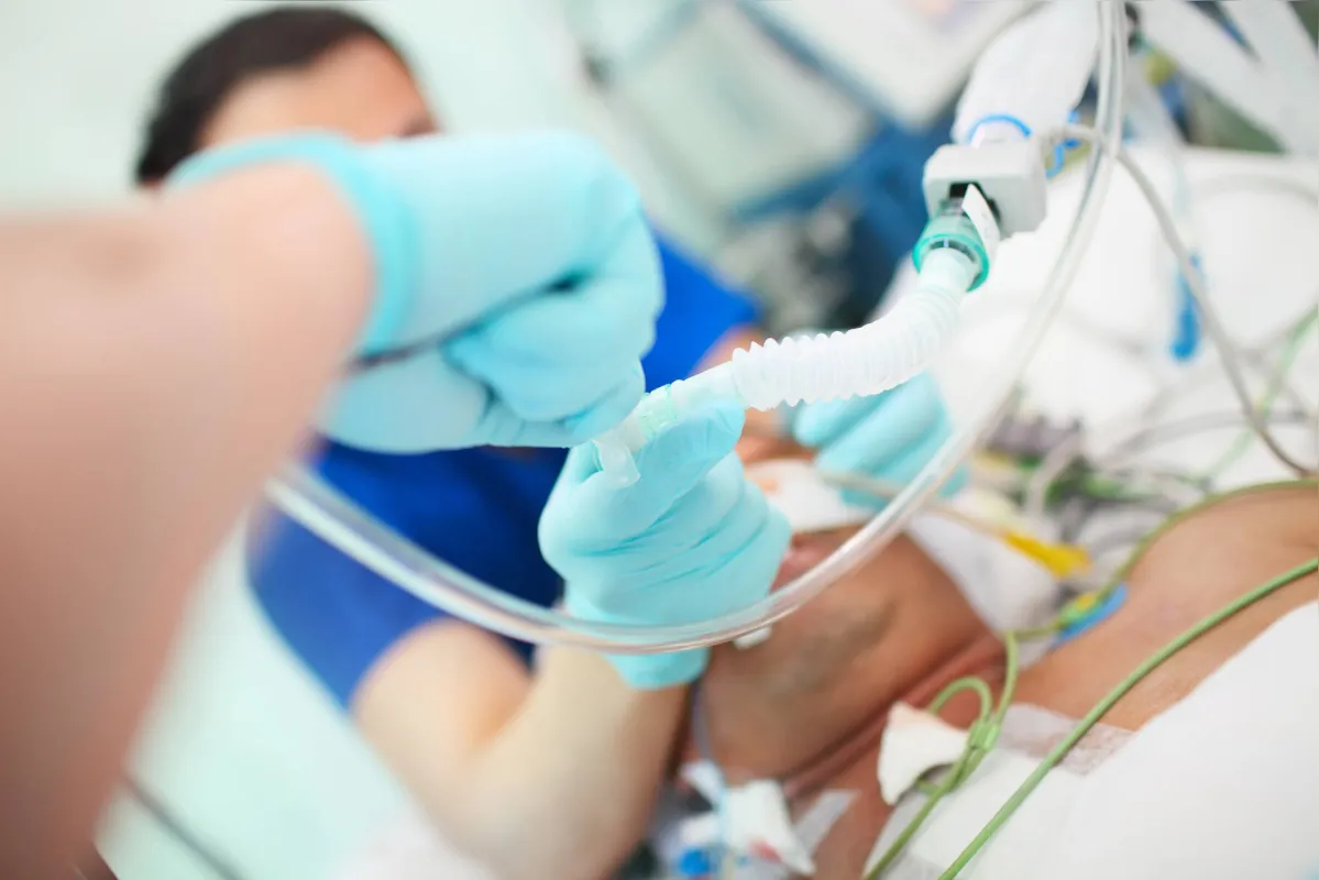 Imagem ilustrativa da imagem Paraná tem um respirador pulmonar para cada UTI