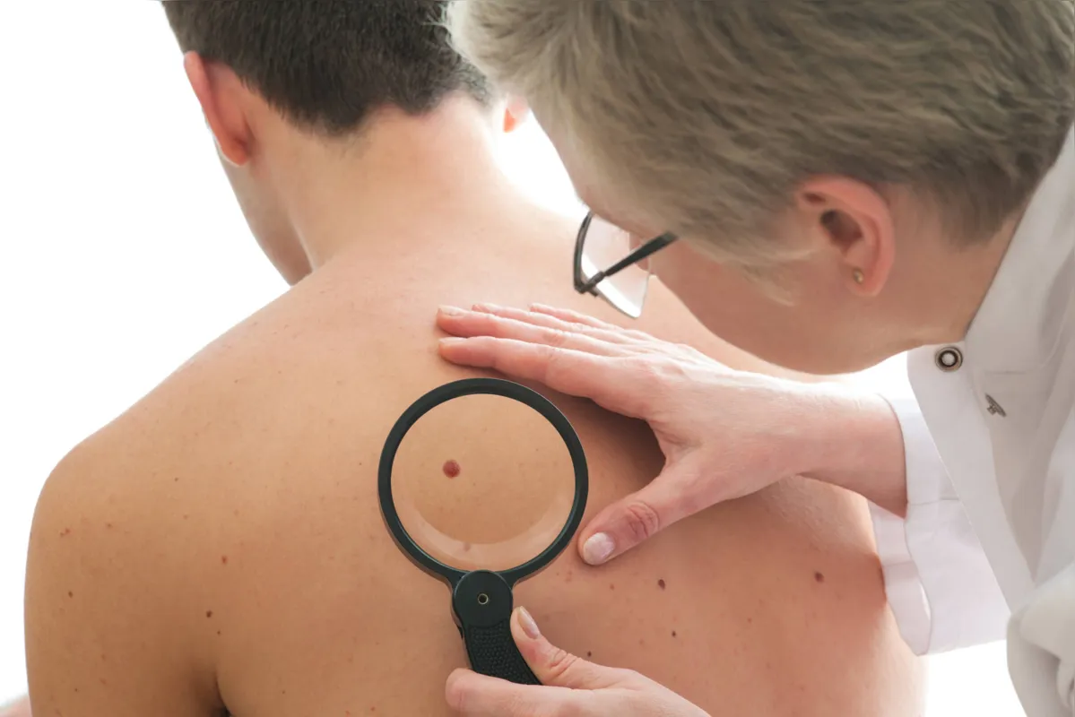 Imagem ilustrativa da imagem Pesquisadores desenvolvem software para diagnosticar melanoma