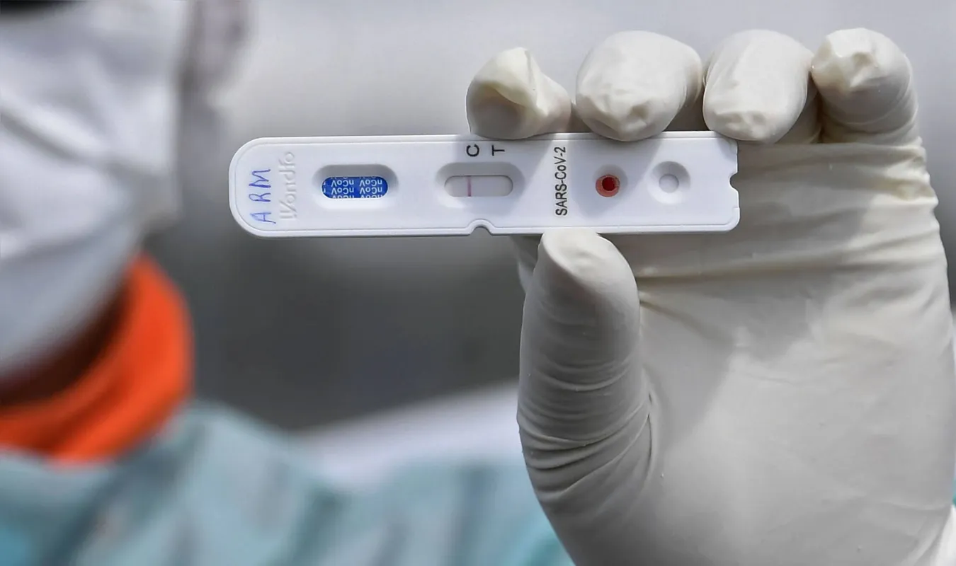 De acordo com a Abrafarma, 14,87% dos pacientes apresentaram anticorpos para o coronavírus  