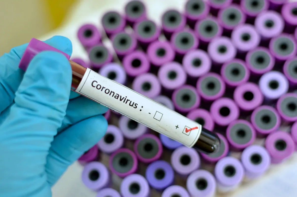 Imagem ilustrativa da imagem Paraná chega a 1.835 casos de coronavírus e 109 mortes
