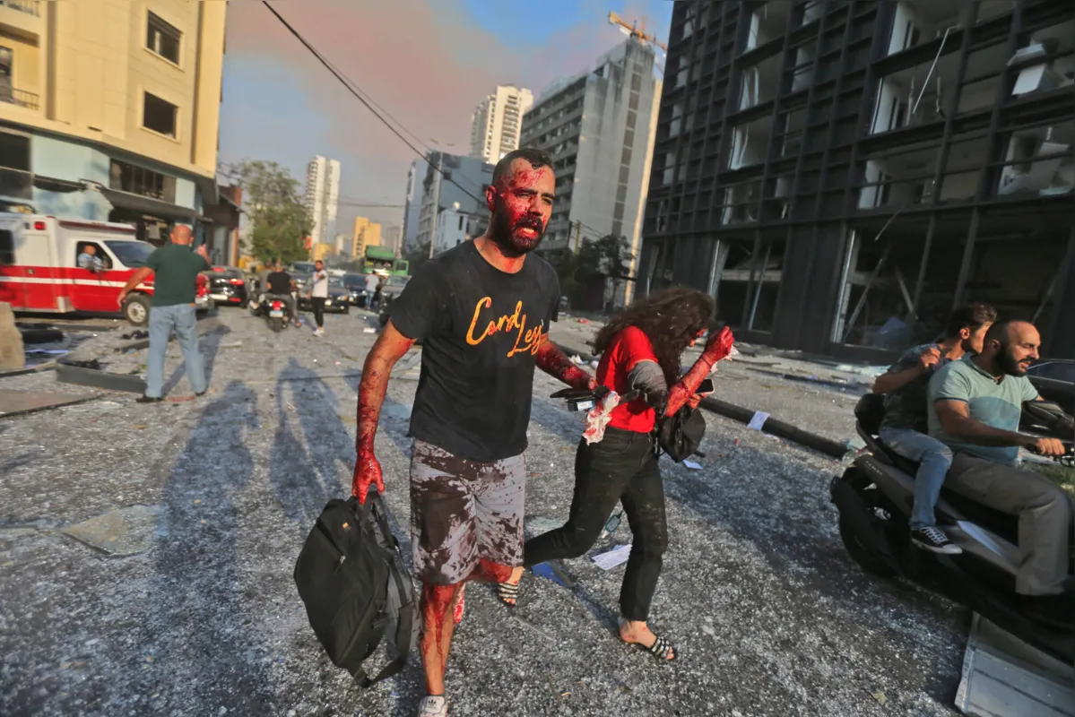 Feridos buscam socorro nas ruas de Beirute: hospitais lotados 
