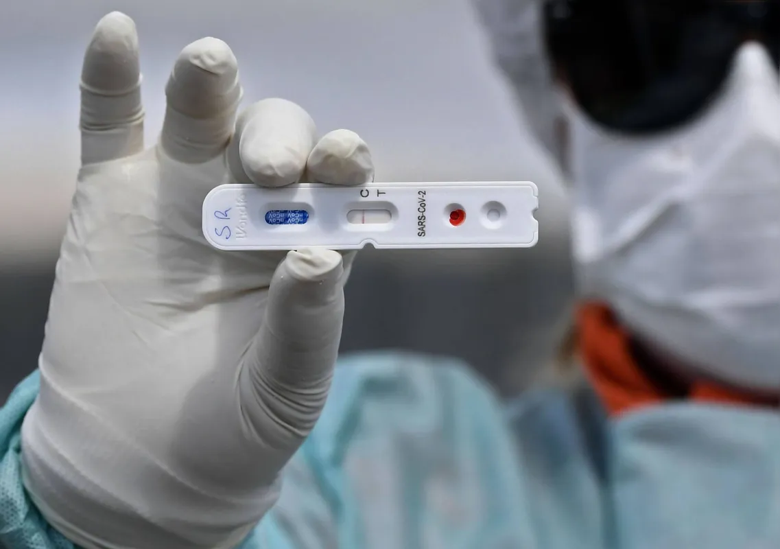 Imagem ilustrativa da imagem Secretaria de Saúde confirma mais 105 casos da Covid-19