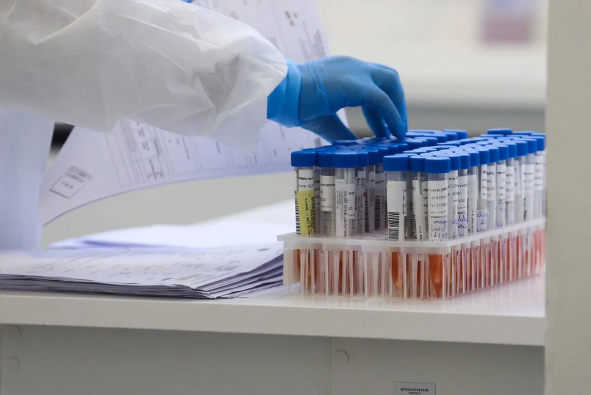 Imagem ilustrativa da imagem Paraná ultrapassa a marca de 175 mil casos da Covid-19